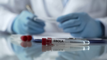 Jadi Pandemi di Guinea, Mungkinkah Virus Ebola Sampai Negara Kita?