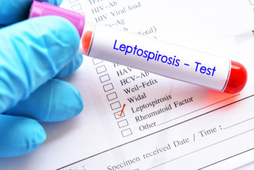 Mengenal Leptospirosis, Penyakit yang Perlu Diwaspadai Saat Musim Hujan